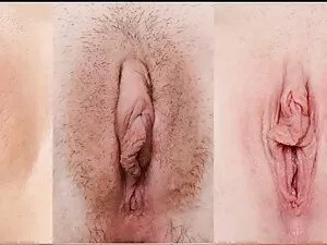 Vixen MIA Melano alo ...